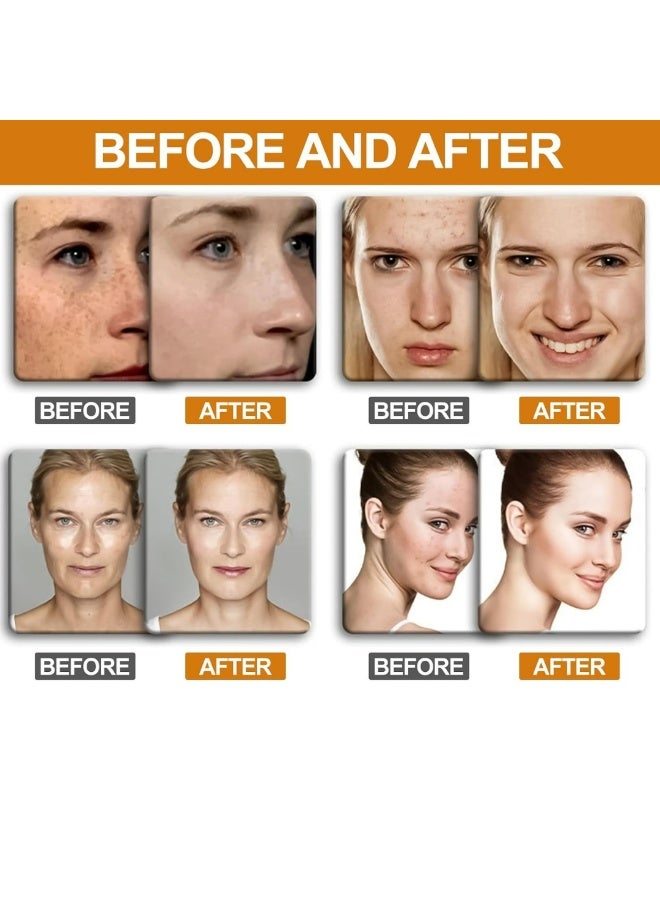 Kanza 3Pcs Turmeric Kojic Acid Soap Set for Face & Body Handmade Turmeric Kojic Acid Facial Soap for Acne Dark Spot Remover Face Cleansing Smooth Skin Moisturizing Soaps with Retinol & Collagen 3 x 65g - Image 4